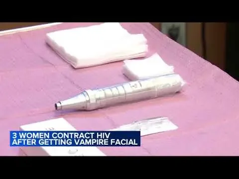 3 women diagnosed with HIV after getting "vampire facial" procedures