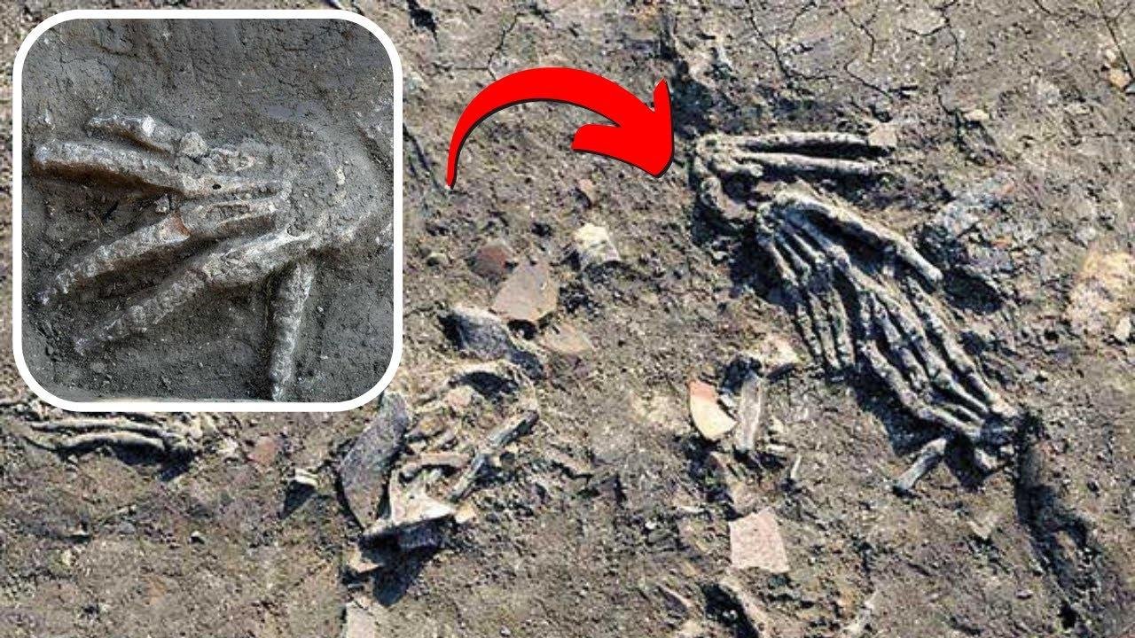 First osteological evidence of severed hands in Ancient Egypt