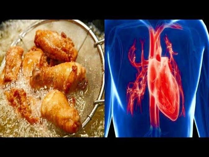 Foods To Avoid For Heart Disease Heart Health Videos Foods4Health 