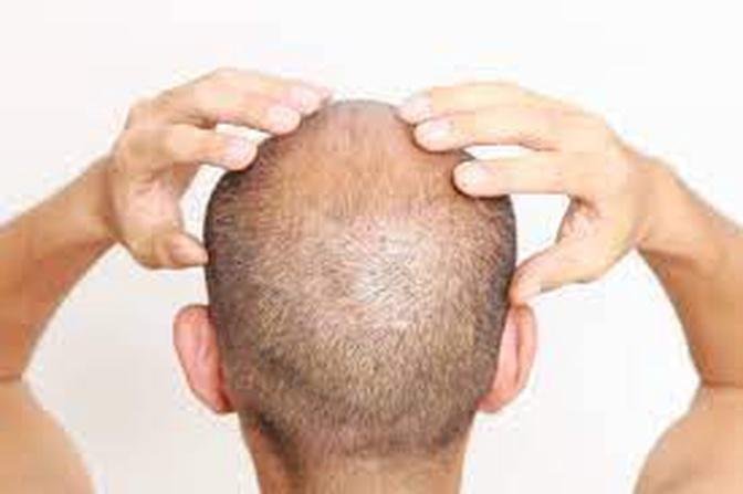 What should I do if I'm not satisfied with the results of FUE Hair Transplant in Dubai?