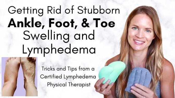 Toe, Foot, and Ankle Lymphedema and Swelling - Tricks to get Rid of ...