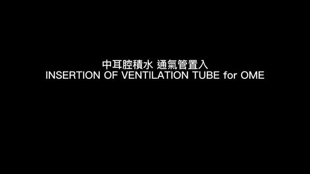 中耳積水 通氣管置入 insertion of ventilation tube for middle ear effusion
