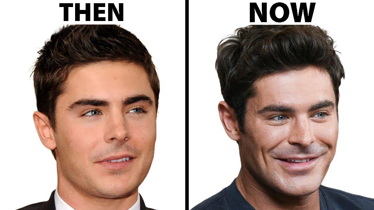 Is Zac Efron's Face All Natural? | Plastic Surgery Analysis