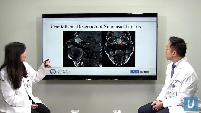Minimally Invasive Endoscopic Surgery for Skull Base Tumors | UCLAMDChat