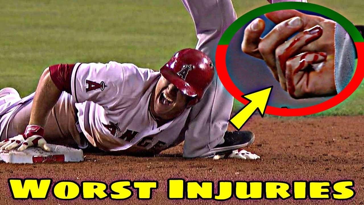 MLB \\ Worst Hand Injuries