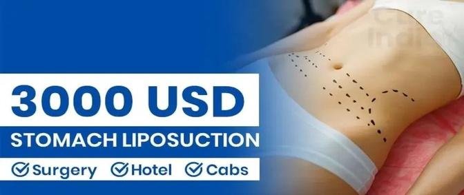 Liposuction Price In India: A Look At The Costs Of Cosmetic Change
