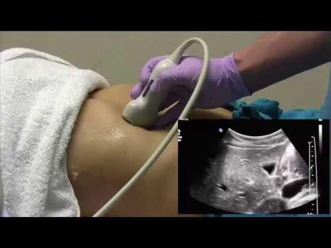How I do it Ultrasound of the Abdomen