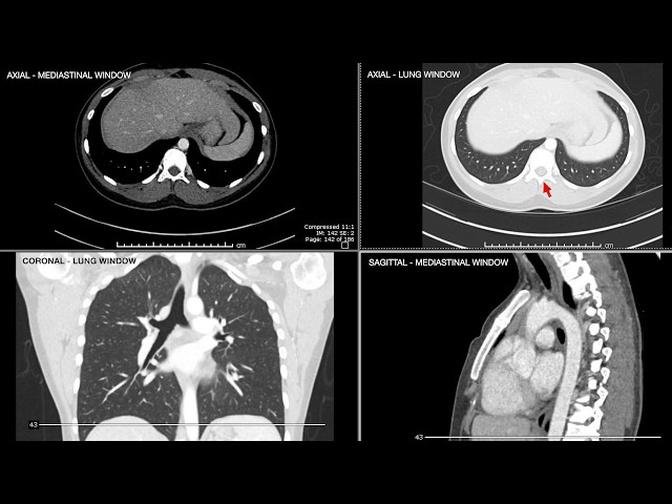 Introduction to Computed Tomographic imaging of the Chest