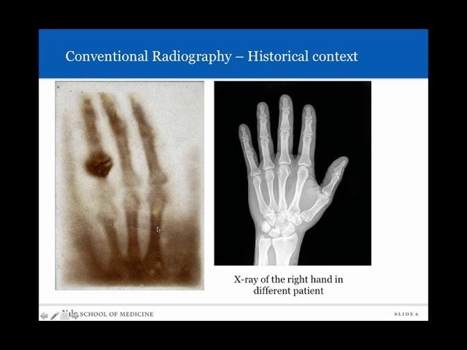 Introduction to Radiology Conventional Radiography